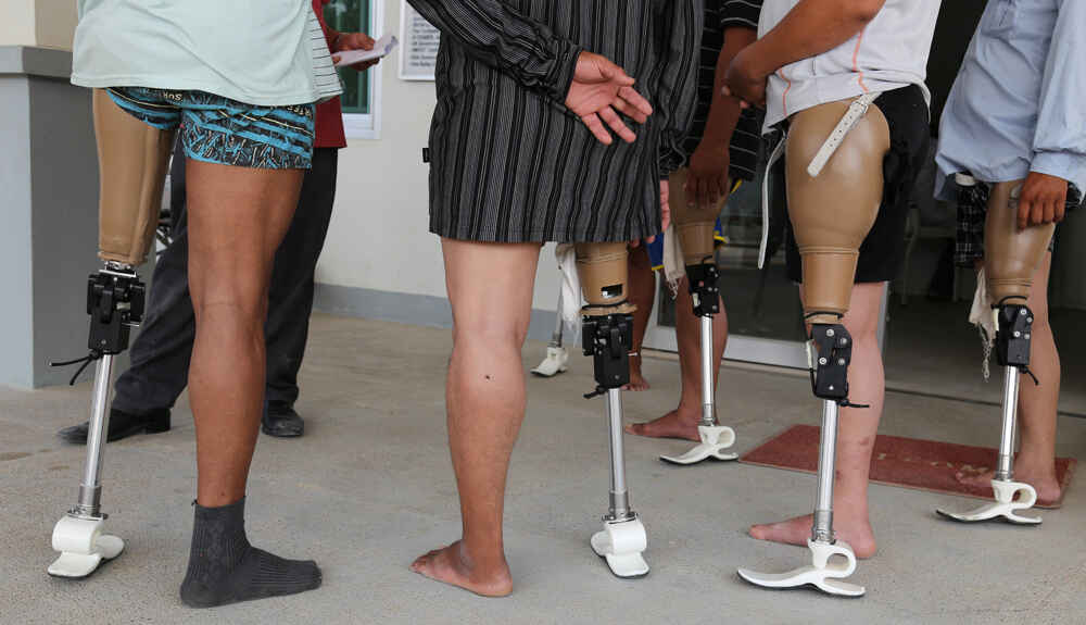 We can transform a life by providing prosthetic devices and rehabilitation image